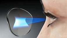 Optical Sight