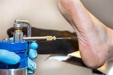 Strapping System